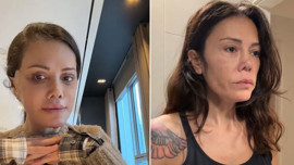 Yüz nakli operasyonu geçirmişti! Eski Survivor yarışmacısı Didem Ceran son halini paylaştı