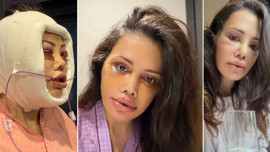 Yüz nakli operasyonu geçirmişti! Didem Ceran'dan kötü haber geldi