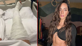 Ayağını kırmıştı! Hepsi grubunun üyesi Yasemin Yürük'ten haber geldi