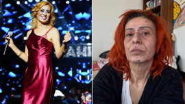 Yüzünde kimyasal yanık oluşmuştu! Yıldız Tilbe artık saçlarında 4 malzeme kullanıyor: Formülü verdi