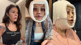 Yüz nakli operasyonu olmuştu! Didem Ceran son halini paylaştı: Estetik değil, yeniden doğuş!