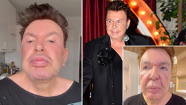 Yüz gerdirme operasyonu geçiren Kuşum Aydın eleştirilere ateş püskürdü: Utanmasalar küfür edecekler!