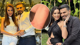 Dilan Polat bir kez daha boşanma kararı aldı! Darp izlerini paylaşıp sildi