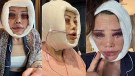 Güney Kore'de yüz nakli olmuştu! Didem Ceran bir kez daha bıçak altına yattı: "Bana kölelik sözleşmesi imzalatmaya kalktılar" diyerek ağladı