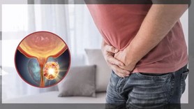 Prostat artık cinselliğe engel değil! İşte merak edilen holep tedavisi