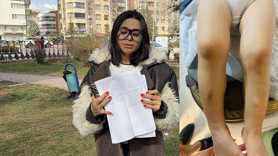 Kreşte darp iddiası! 2 yaşındaki çocuğa eve morluklarla döndü: Atlas okula gelmesin