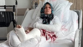 KOLUNU BACAĞINI KIRDILAR! 3 çocuk annesi dehşeti yaşadı