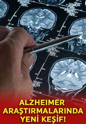 Alzheimer araştırmalarında yeni keşif: Riski artıran genetik varyant bulundu!