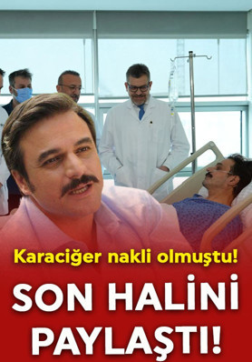 Karaciğer nakli olan Ufuk Özkan'dan yeni paylaşım! İşte son hali