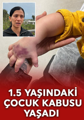 Adana'da 1.5 yaşındaki çocuk dehşeti yaşadı!
