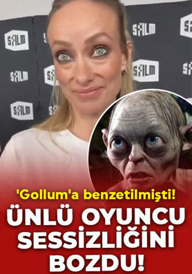 Son hali 'Gollum'a benzetilmişti! Olivia Wilde’dan yorumlara tepki