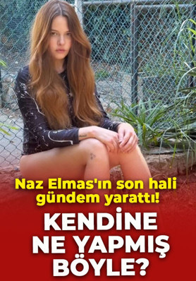 Naz Elmas'ın son hali gündem yarattı! Sosyal medya hesabından paylaştı: "Kendine ne yapmış böyle?"