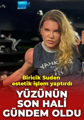 Mazhar Alonson'un eşi Biricik Suden estetik işlem yaptırdı! Yüzünün son hali dikkat çekti