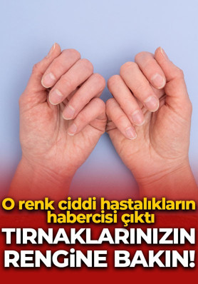 Tırnaklarınızın dibine bakın! O renk değişimi ciddi hastalıkların habercisi çıktı