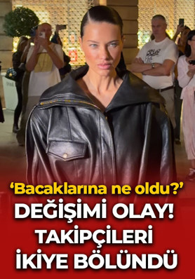 Adriana Lima’nın değişimi olay oldu! “Bacaklarına ne oldu?”