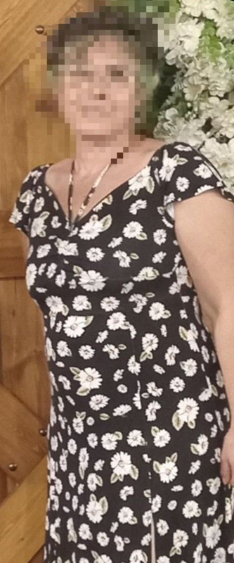 Başkentte aile katliamı! Eski eşi ve kayınvalidesini vurup intihar etti - Resim: 9