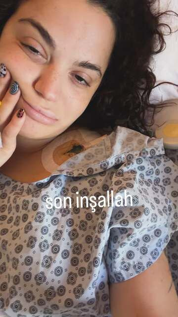 Sağlık sorunlarıyla mücadele ediyordu! Ölümden dönen Aslı Bekiroğlu 8. kez ameliyat olacak - Resim: 4
