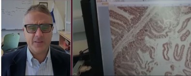 Aç kalmanın kansere karşı durduğu ortaya çıktı! Şaşırtan araştırma - Resim : 1