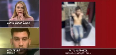 Antalya'da çalıştığı işyerinde akılalmaz işkencelere maruz kalan genç tv100'e konuştu! - Resim : 1