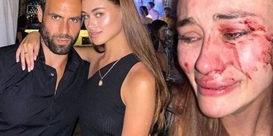 Ukraynalı model Daria Kyryliuk, Çeşme'de saldırıya uğramıştı! Flaş karar - Resim : 2