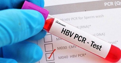 PCR testi kalktı mı? Ameliyat öncesi PCR testi zorunluluğu kalktı mı? Sağlık Bakanlığı resmi yazıyla duyurdu! - Resim : 1