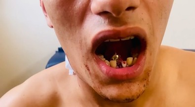 Pendik'te akıl almaz olay! Az daha can alıyordu! Boynundan girip ağzında kaldı! - Resim : 2