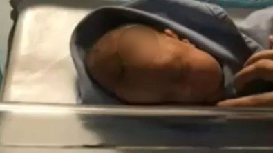 Yer: Tekirdağ! Doktor neşterle annenin karnını kesmek isterken bebeğin de başını kesti! Her bir detayda dehşete düşeceksiniz - Resim : 1