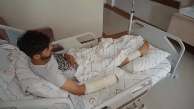 Ayı dehşeti hastanelik etti! Elini ve ayağını kaptıran genç o anları anlattı: Neye uğradığımı şaşırdım - Resim : 1