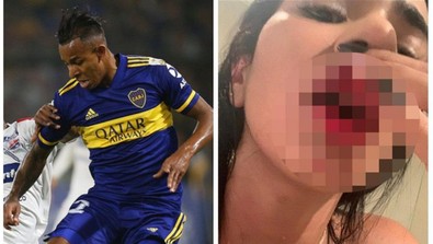 Ünlü futbolcunun eski sevgilisinden şok iddia!.. Dayaktan bebeğini düşürmüş! - Resim : 2