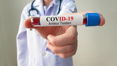 PCR testi kalktı mı? Ameliyat öncesi PCR testi zorunluluğu kalktı mı? Sağlık Bakanlığı resmi yazıyla duyurdu! - Resim : 2