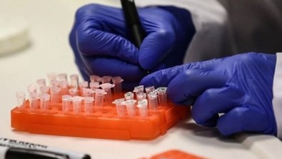Sağlık Bakanlığı'ndan maymun çiçeği rehberi: M Çiçeği (mpox) virüsü hakkında bilinmeyenler! M çiçeği (mpox) virüsü nasıl bulaşır? Belirtileri neler? - Resim : 1