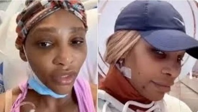 Dünyaca tanınan efsane tenisçi Serena Williams'tan hayranlarını endişelendiren açıklama! Boynunda kocaman kist çıktı - Resim : 1