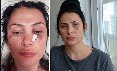 Öğretmen dehşet saçtı!.. Polislerin gözü önünde komşusunun yüzüne kalem sapladı! - Resim : 1