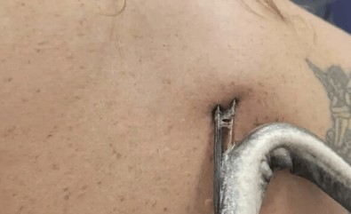 Suda yüzen kadın, saçını ıslatmak için suya kafasını batırdı. Tam çıkaracakken büyük bir acı hissetti... Elini sırtına attığında dehşeti yaşadı - Resim : 1