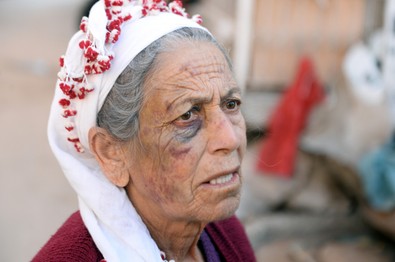 20 dakika süren dehşet! 72 yaşındaki kanser hastası kadını bayıltana kadar dövdü! İfadesi şoke etti: Şansımı denedim - Resim : 1