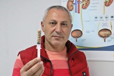 Doktordan ilginç '29 Ekim' kutlaması: Hastadan çıkan böbrek taşlarıyla yazdı! - Resim : 1