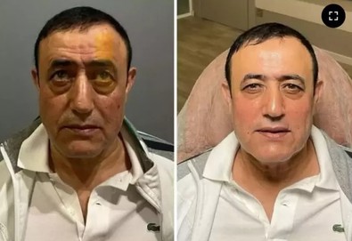 Mahmut Tuncer'i hiç böyle görmediniz! Yüzündeki değişim sosyal medyanın diline düştü! "Görünce tanıyamadım" - Resim : 1