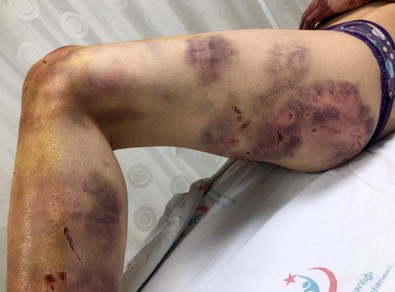 Bu caniliğin tarifi yok!.. Her satırı korkunç!.. Eve kilitlediği eşine günlerce..! - Resim : 2