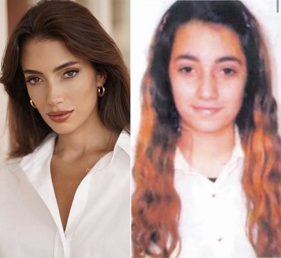 Ünlü fenomen Rachel Araz'ın estetiksiz hali şoke etti! - Resim : 2