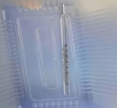 Akılalmaz olay: 12 yaşındaki çocuğun cinsel organından çıkan şey dehşete düşürdü! Doktorlar bile inanamadı - Resim : 1