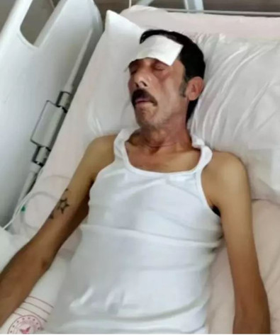 Ünlü türkücü Ankaralı Turgut'tan kahreden haber! Apar topar hastaneye kaldırıldı, son hali korkuttu - Resim : 2