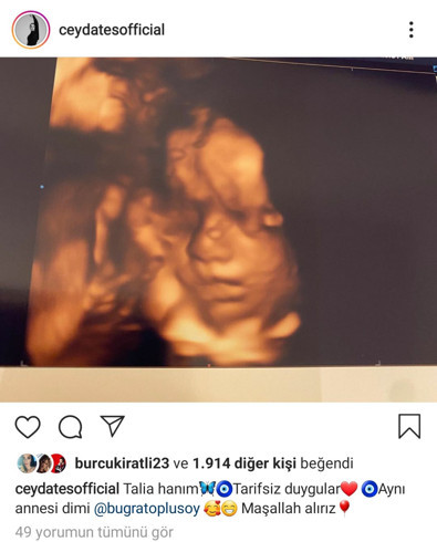 Ceyda Ateş bebeğinin ultrason görüntüsünü paylaştı - Resim : 1