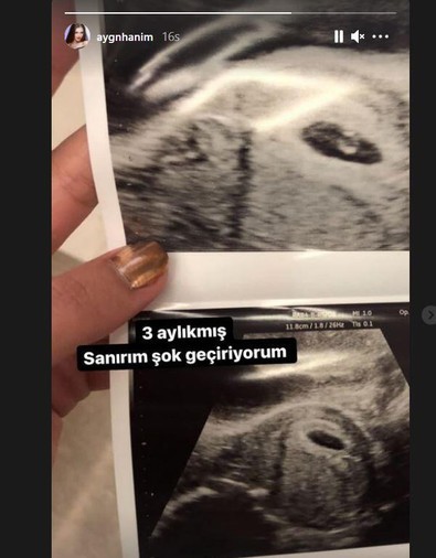 Hakan Sabancı ile ilgili yaptığı paylaşımlarla gündem olan Aygün Aydın hamile mi? Utrason görüntüsü yayınladı - Resim : 1