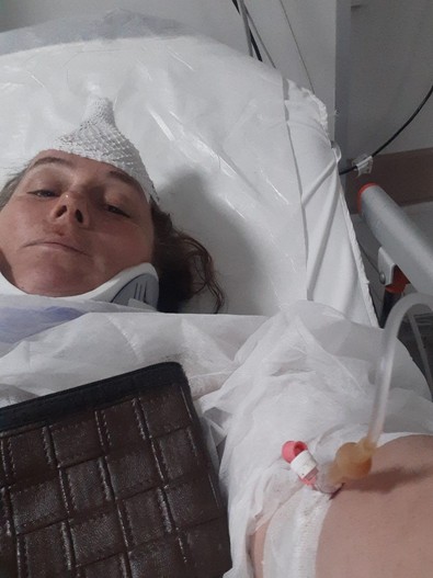 Kocaeli'de ilginç bir olay yaşandı! Denizde yüzerken jet ski çarptı! Ölümden dönen kadın kanlar içinde kaldı! - Resim : 1