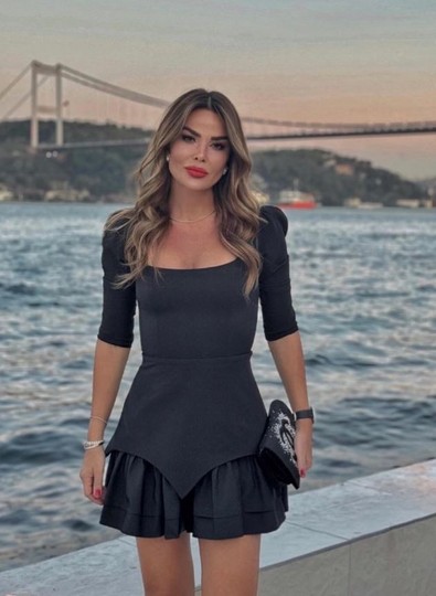 Dudak eleştirisine dayanamayan Özlem Yıldız'dan takipçisine olay yanıt! - Resim : 2