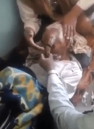 Kafasında bir sabah boynuzla uyanmıştı... 140 yaşındaki adamla ilgili tüyler diken diken eden gelişme - Resim : 1