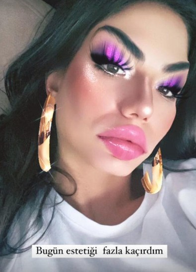 Demet Özdemir'den şoke eden açıklama: Estetiği fazla kaçırdım - Resim : 1