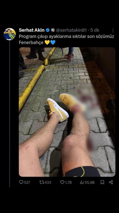 Serhat Akın’a silahlı saldırı - Resim : 1
