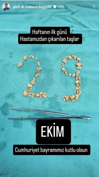 Doktordan ilginç '29 Ekim' kutlaması: Hastadan çıkan böbrek taşlarıyla yazdı! - Resim : 2