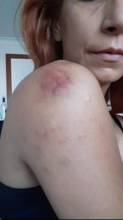 Genç veteriner işkenceyi böyle anlattı: Sadistlik boyutunda! - Resim : 1